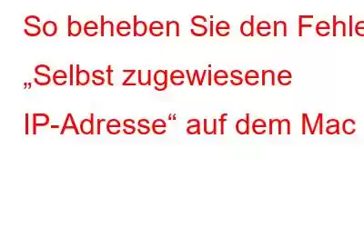 So beheben Sie den Fehler „Selbst zugewiesene IP-Adresse“ auf dem Mac